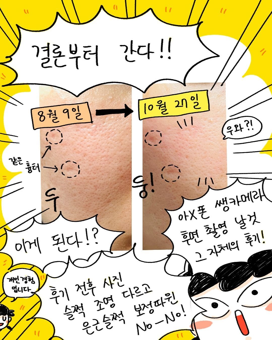 Photo shared by 박가가 수영일기/운동일기/아무말일기 on November 10, 2025 tagging @cellinshot_official. May be an illustration of ‎pie and ‎text that says '‎11 결론부터 간다!! 8월9일 8월9일[10월2지 10월 [0월27일 월 27일 27 111 같은 터)다) 흉터 우와?! ?ㅣ 이게 된다!? 아X폰 心 생카메라 후면 촬영 날것 ح 자체의 후기! 개인 경험 입니다. 후기 전후 사진 다르고 보정따원 솔적 조명 은근슬쩍 No-No! No‎'‎‎.