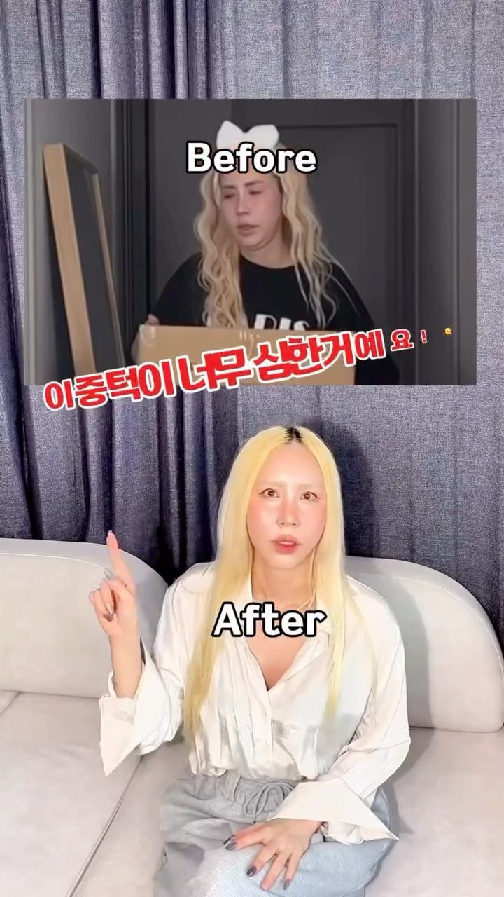 bada_pinky 게시물 이미지: 요즘 이중턱이 너무 심하더라구요!ㅠㅠ
어릴때부터 이중턱이 있긴했는데 (원래 이중턱을...