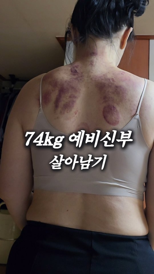 bboiet 게시물 이미지: 74kg 예비신부 살아남기...

사실 저도 살 빠진 것에만 더 집중하긴...