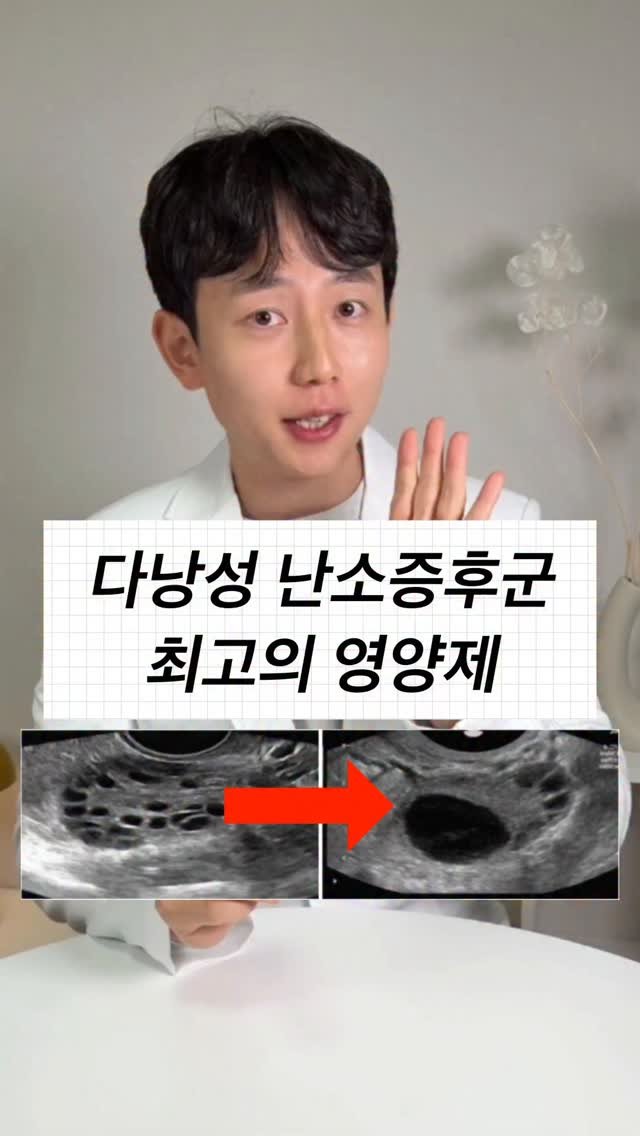 bbuuu_yaksa 게시물 이미지: 🎈다낭성 난소증후군(PCOS) 좋아지는
영양제 꿀조합 깔끔정리 :)
⠀
💡다낭성...