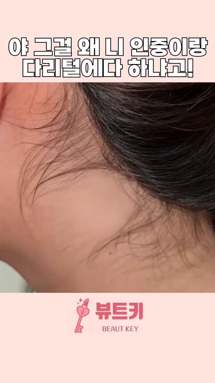 beautkey_ 게시물 이미지: 제가 뒤에 잔머리하고 얼굴 잔털이 쪼금 빨리자라
자주 없애주는데.. 🫣
남편이...