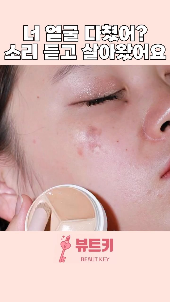 beautkey_ 게시물 이미지: 얼굴에 반점이 있어서 어렸을때부터
너 얼굴 멍들었는데? 어디 다쳤어?
들으면서...