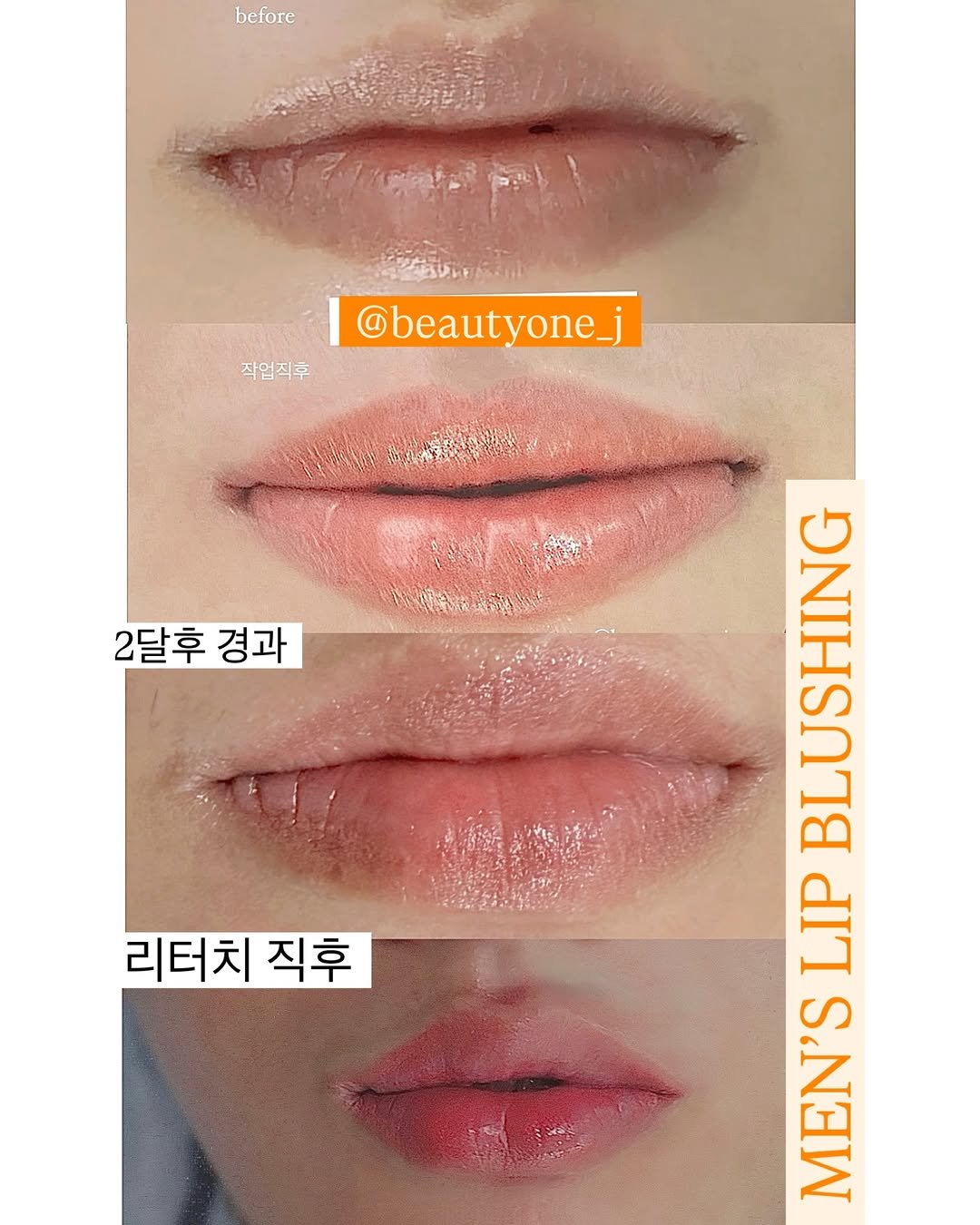 Photo by アートメイク 韓國アートメイク 남자눈썹문신 눈썹문신 강남 입술문신 반영구수강 반영구학원 뷰티원 정예원 in Seoul, Korea with @beautyone_global. May be an image of 3 people, lipstick and text that says 'before ADE 작업직후 작업직후 @beautyone_j SR y 福牛凝品路 2달후 경과 리터치 직후 USHI MEN'SLIP S MEN'S LIP'.
