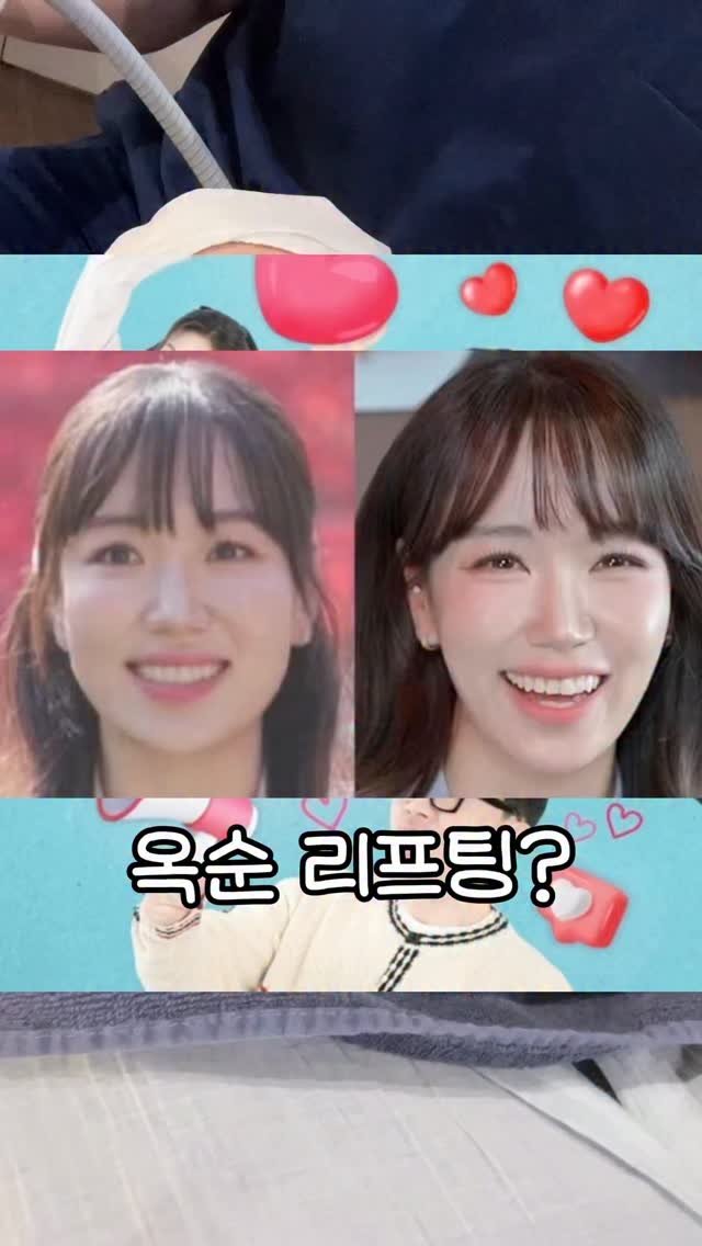 beautyr_yul 게시물 이미지: 옥순리프팅이 뭔데?? #7일간 변화

울쎄라 써마지 효과를 
동시에 볼수있는...