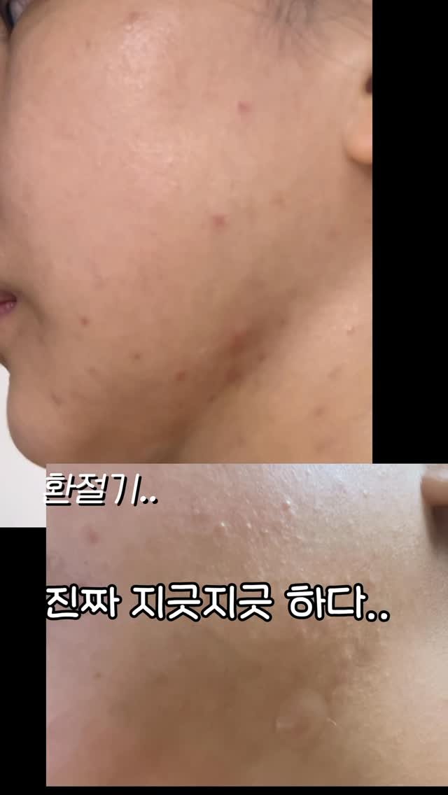 beautyr_yul 게시물 이미지: @bringgreen_official
민감 피부 언제 가장 심해지세요?
전...