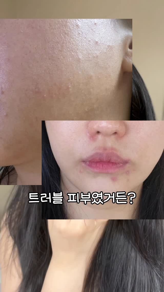 beautyr_yul 게시물 이미지: 레티날이 처음 사용하신다면?😳

피부에 효과가 높은 만큼
자극에 고민있으실거...