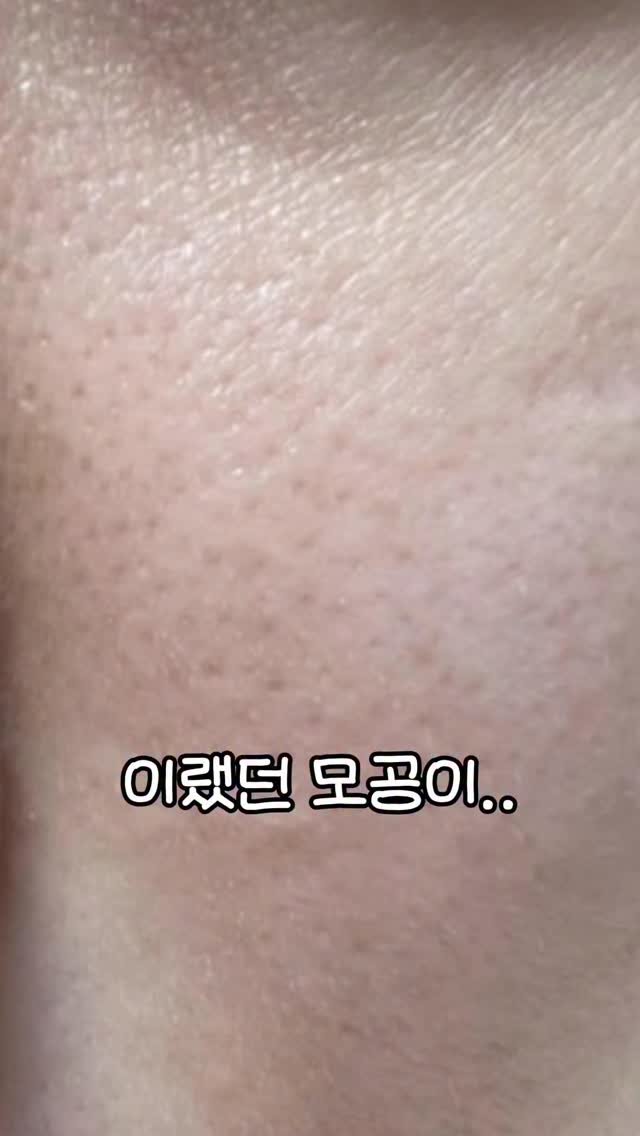 beautyr_yul 게시물 이미지: #광고 (innisfreeofficial)
모공 고민쫌 해봤다 하면
레티놀이 좋다는...