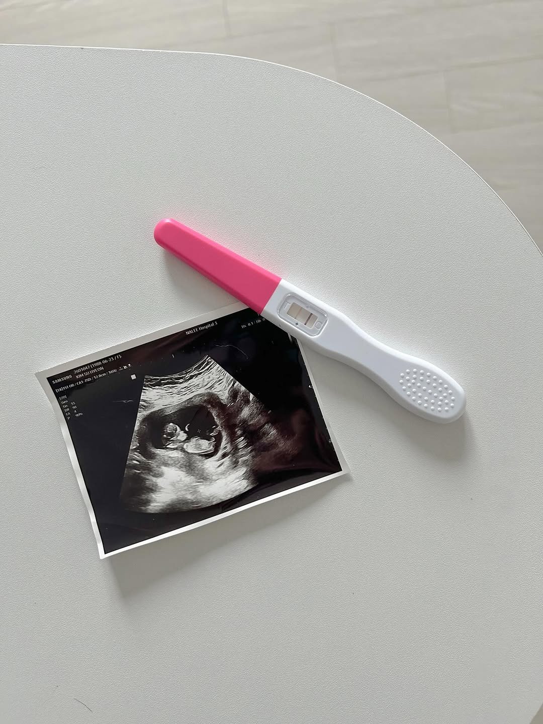berry_a_day 게시물 이미지: #임밍아웃#15w
갑작스런 임밍아웃🍼

소이에게 여동생이 생겼어요!

알게된 건 꽤...