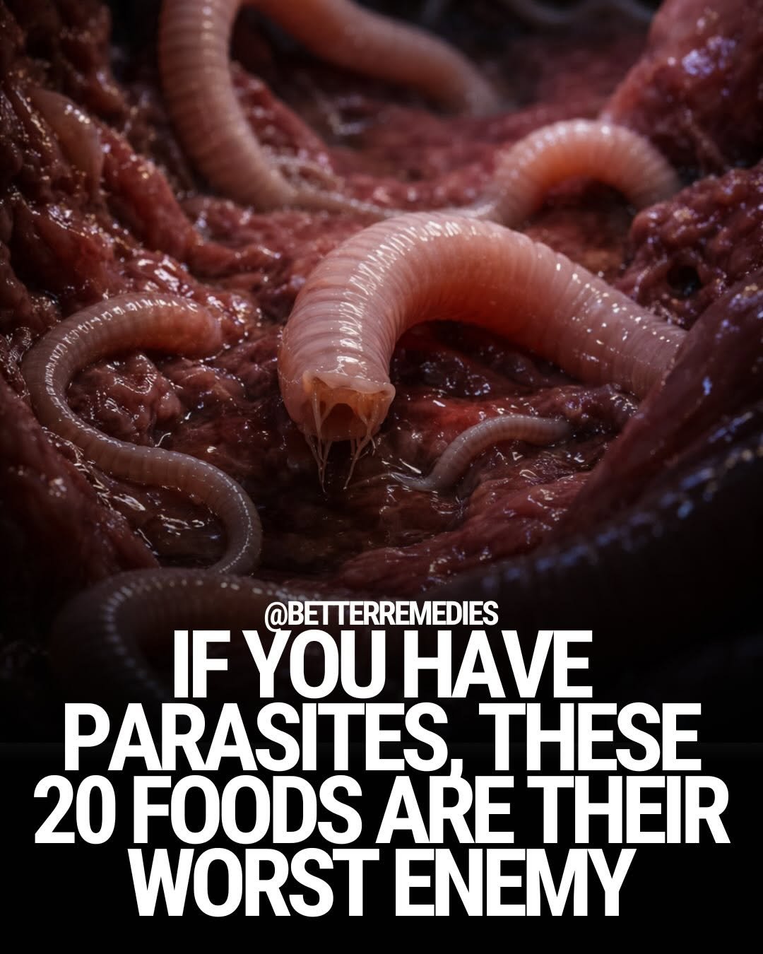 Photo shared by Natural Remedies on January 18, 2026 tagging @naturethecure. May be an image of worm and text that says '@BETTERREMEDIES IF YOU HAVE PARASITES THESE 20 FOODS ARE THEIR WORST ENEMY'.