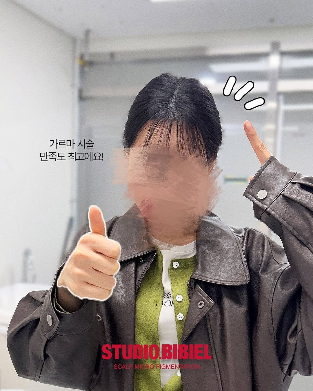 bibiel_smp 게시물 이미지: 가르마 시술 진짜 만족도 최고라구 엄지척 날려주신 고객님👍🏻
넘 귀여우셔서 얼른...