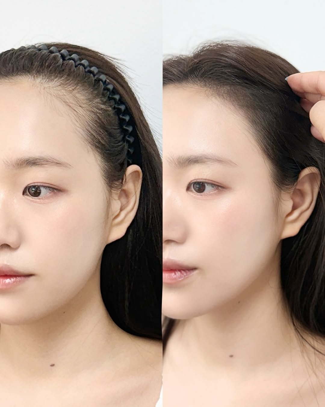 bibiel_smp 게시물 이미지: 물놀이 많은 여름, 앞머리 정돈이 힘든 더운 날씨엔
헤어라인이 더 신경 쓰이죠...