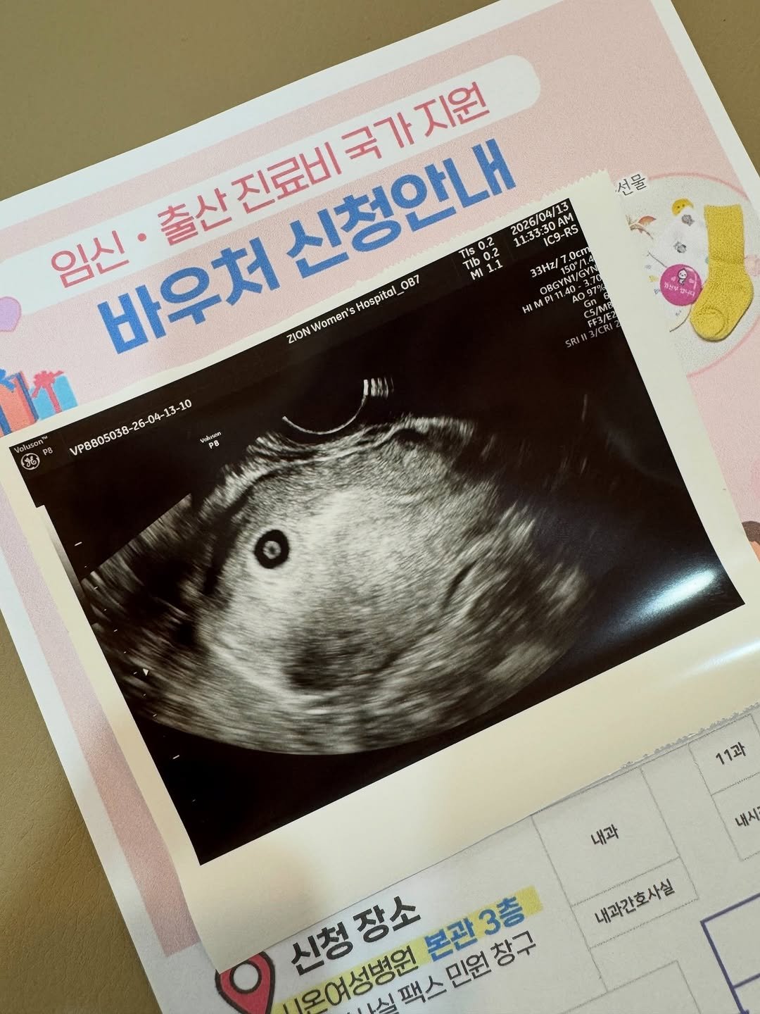 blackbono_bonggil 게시물 이미지: 우리 셋째 말랑이, 엄마 아빠한테 잠깐 왔다가 하늘의 별이 됐어요.

나중에...