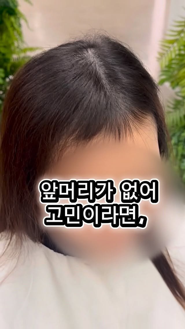 blankyou.eunpa 게시물 이미지: 항암치료후, 앞머리가 더이상 자라지않는 고객님 

아무리 길러도 앞머리가...