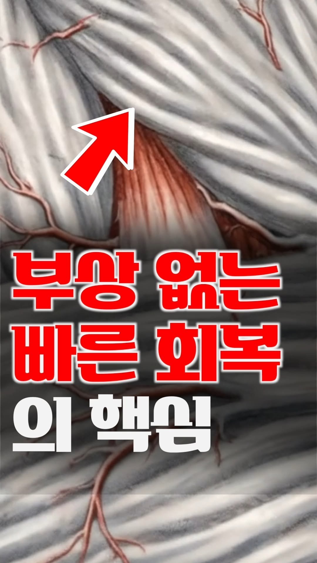 bliss_note 게시물 이미지: 운동전후 이런 스트레칭? 근육 망가집니다

운동 전후에 하는 정적 스트레칭,
오히려...