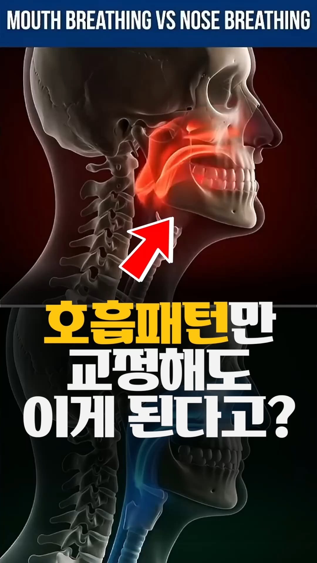 bliss_note 게시물 이미지: 코로 숨쉬면 벌어지는 믿기 힘든 일...!?

거북목 때문에 스트레칭, 마사지, 턱...