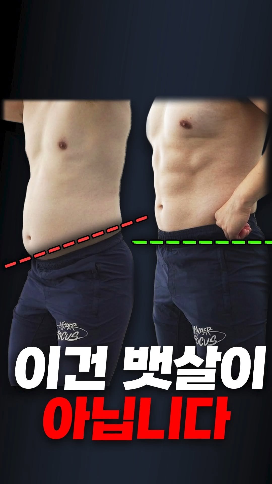 bliss_note 게시물 이미지: 전방경사,
“장요근이 왜 자꾸 뻣뻣해지는 걸까요?”

늘려서 풀어도
다시 돌아오는...