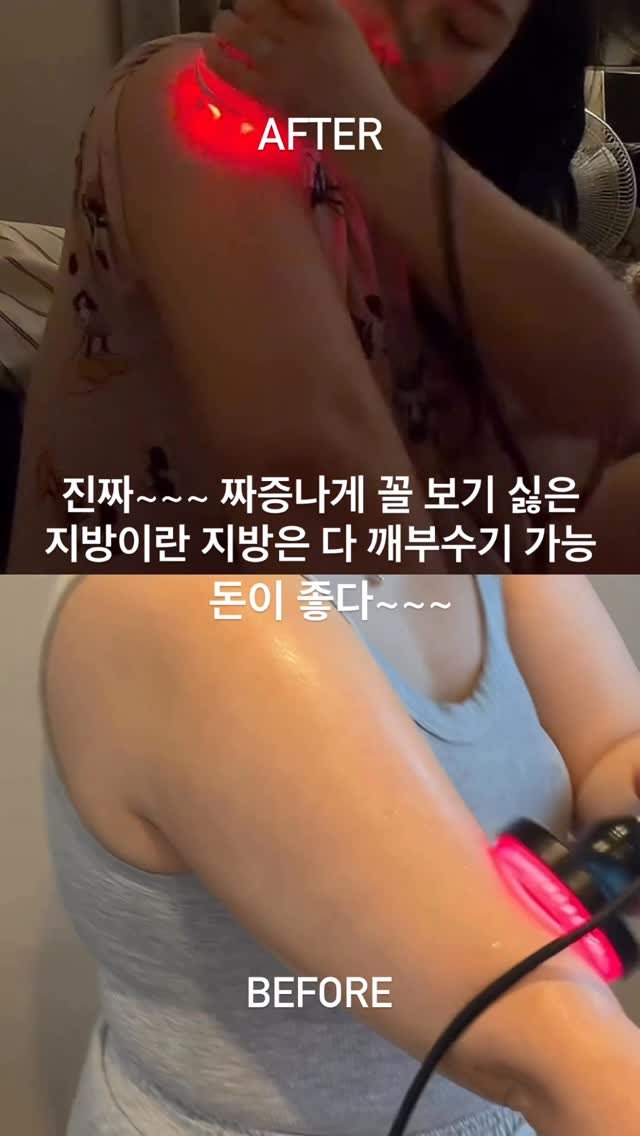 blissb__ 게시물 이미지: 세상이 너무 좋아~~~~

문질문질하면 지방이 박살나네요..?
원리를...