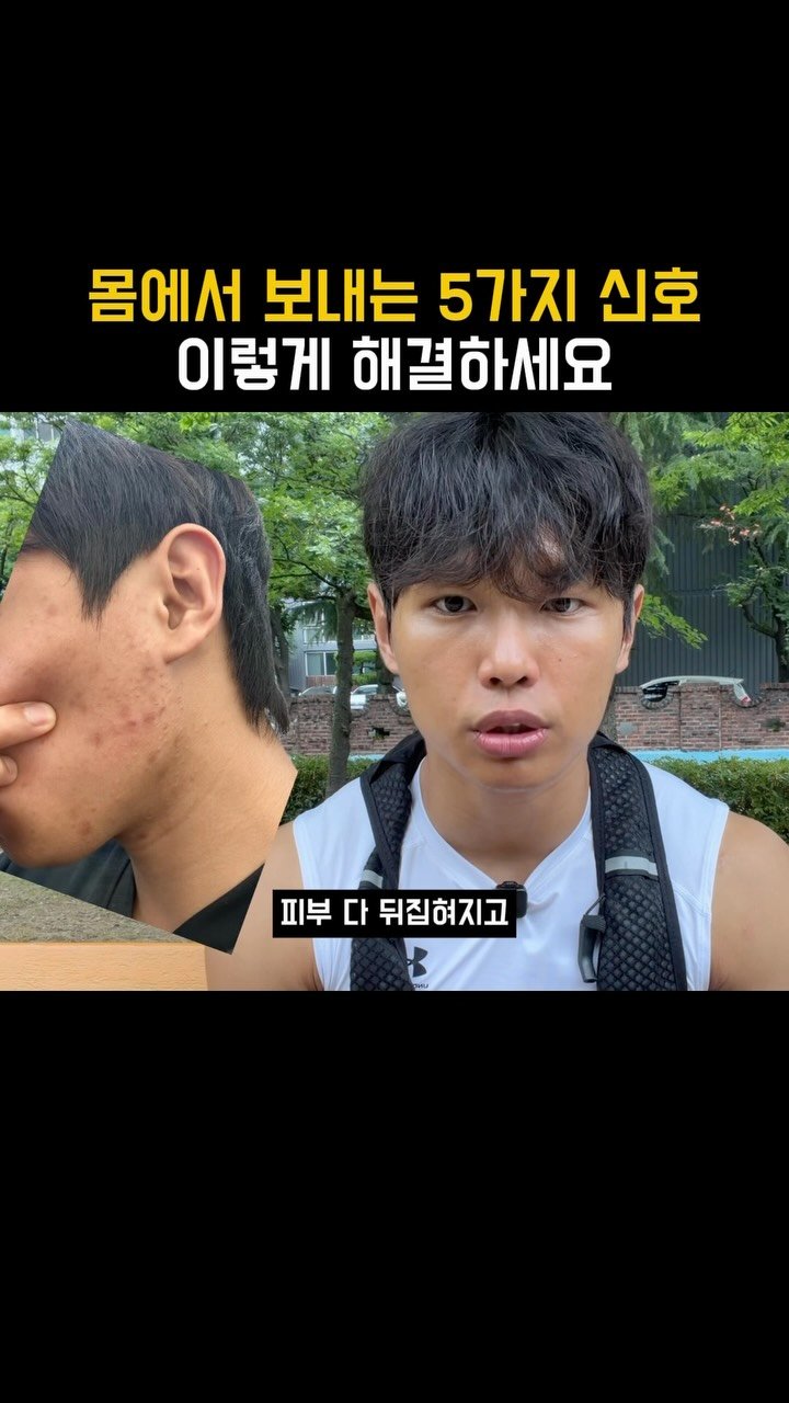 bllack__horse 게시물 이미지: 수면을 못하면 몸에서 이런 일들이 벌어짐.

1. 코르티졸 증가
수면 부족 →...