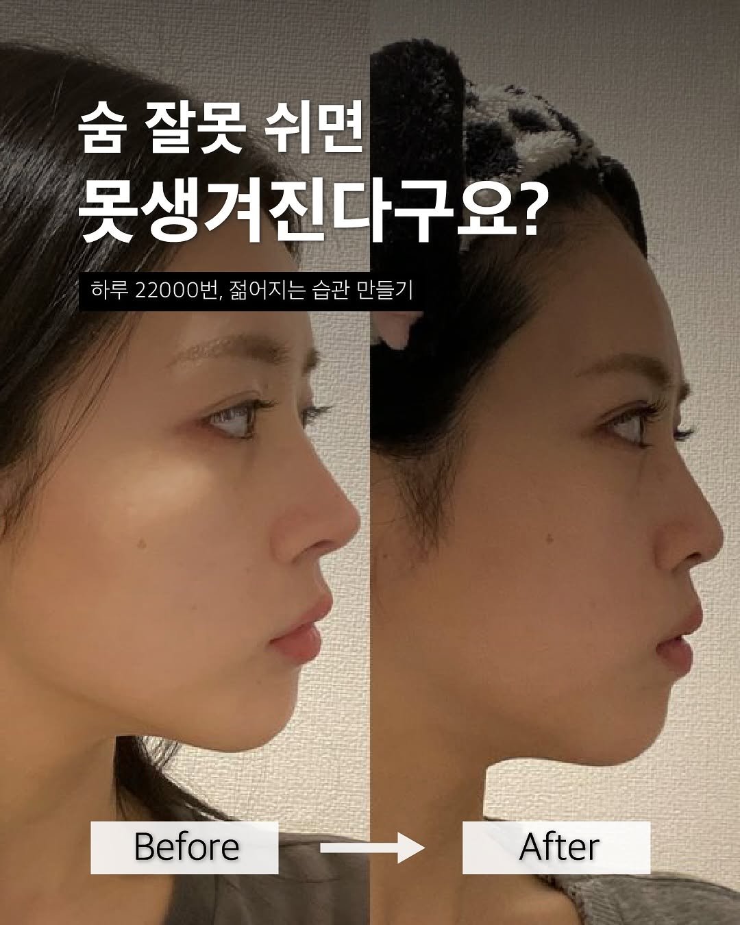 Photo by 밥프로디테  │  다이어트 · 피부관리 on November 06, 2025. May be an image of text that says '숨 숨잘못쉬면 잘못 쉬면 못생겨진다구요? 하루 하루22000번,정어지는슬관만들기 22000번, 젊어지는습관만들기 만들기 젊어지는 습관 Before After'.