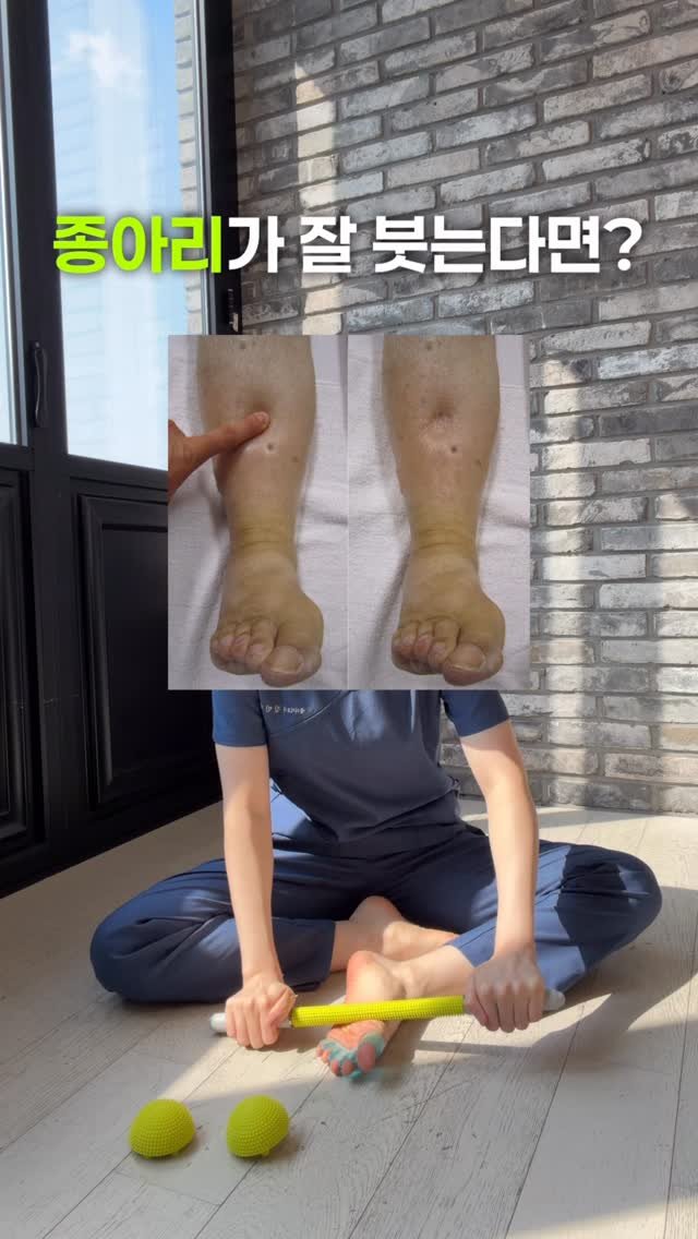 body_heals 게시물 이미지: 종아리가 자주 붓는다면
종아리만 풀어서는 부족합니다 ❌

✅ 발바닥부터...