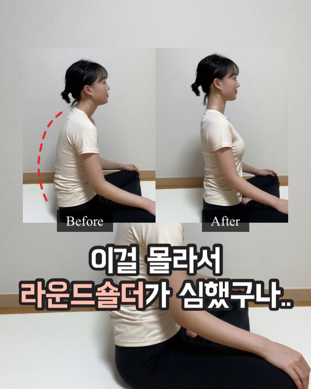 Photo by 바디힐즈 | 재활홈트 𝐍𝐨.𝟏 on July 31, 2025. May be an image of 3 people and text that says 'Before After 이걸 몰라서 라운드솔더가 심했구나..'.