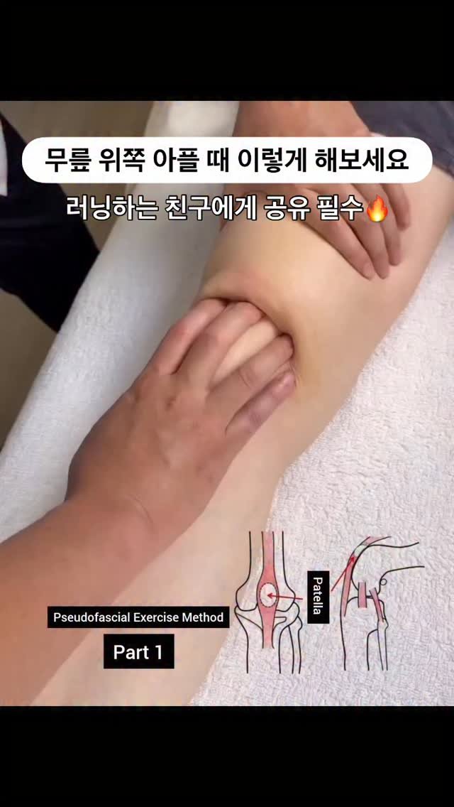 body_heals 게시물 이미지: ❗️아직도 허벅지 폼롤러만 하고 계신가요? 

무릎 위쪽이 아프다면
이 힘줄...