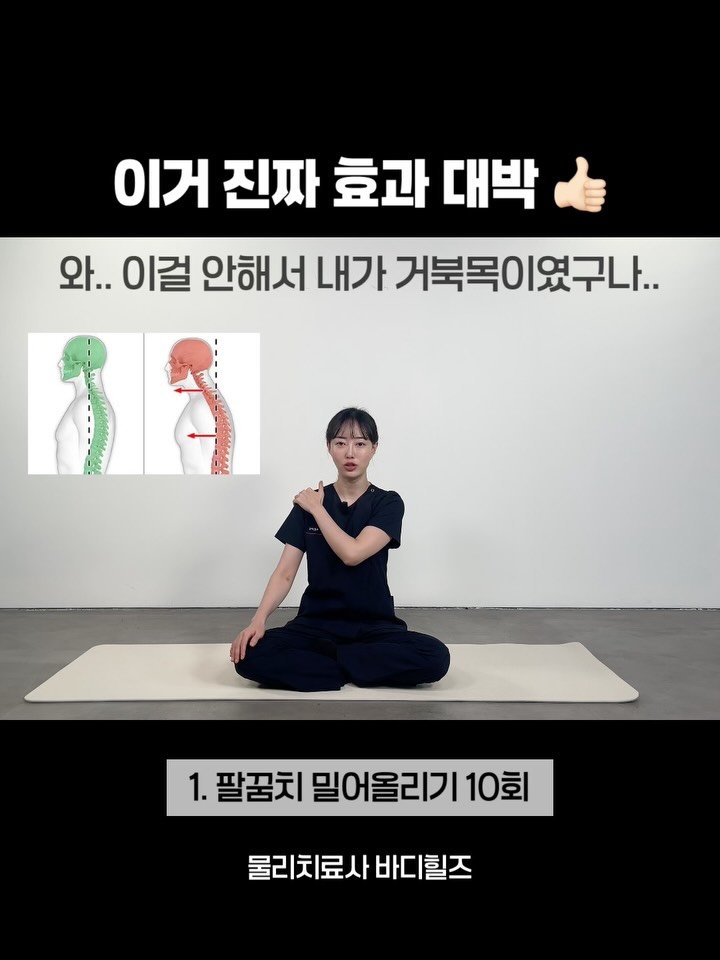 body_heals 게시물 이미지: 거북목 꼭 고쳐야 할까요?

🐢 사실 ‘거북목 증후군’은 정식 의학 진단명이...