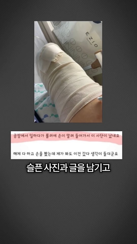 bokyem123_ 게시물 이미지: 팔이 잘린 시청자에게 연락이 왔습니다

#보겸 #보겸TV