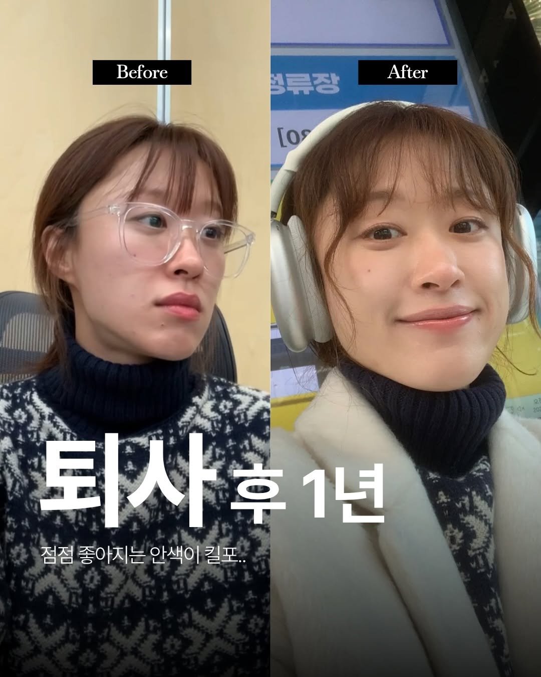Photo by 봉실장ㅣ 기획마케터 on December 30, 2025. May be an image of one or more people, hair, eyeglasses, duffle coat, parka, turtleneck and text that says 'Before 영류장 After [o 퇴사 퇴사후1년 후 1년 점점 좋아지는 좋아지는안색이킬포. 안색이 킬포..'.