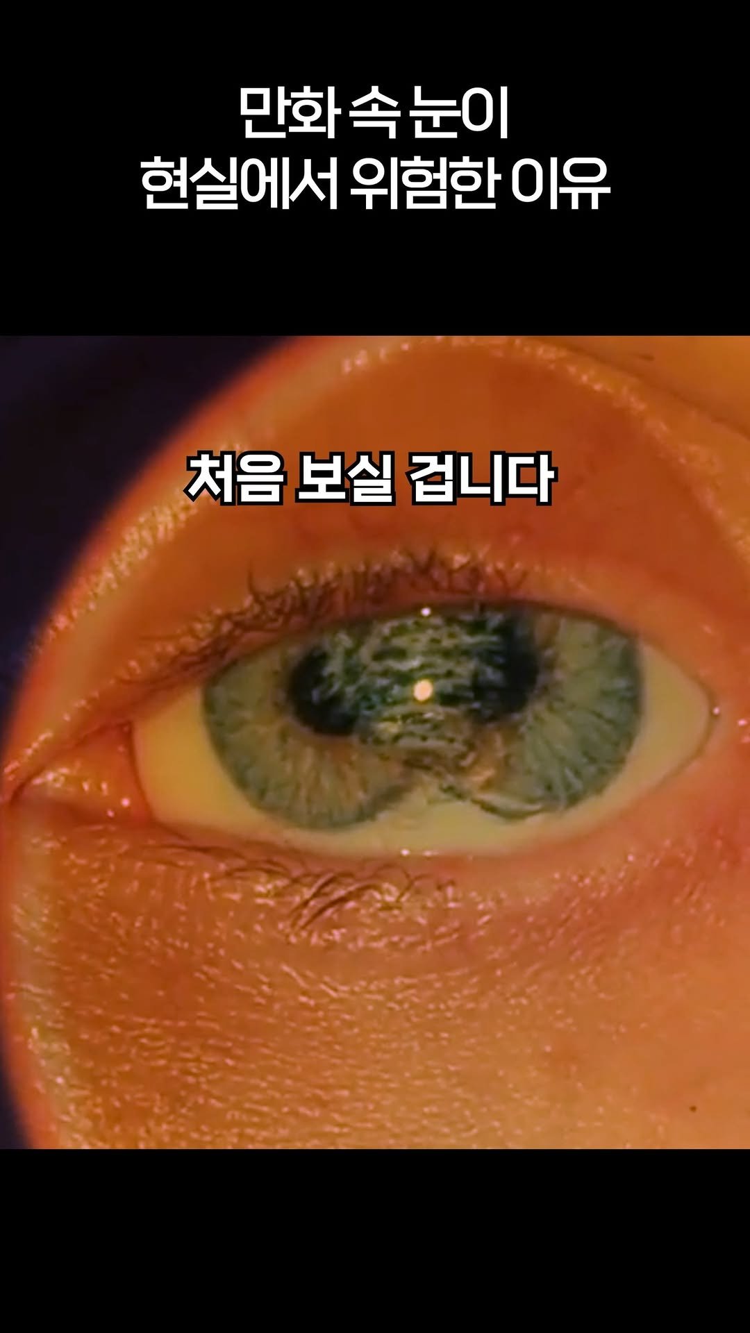 brand_eyeclinic 게시물 이미지: 만화 속 눈을 현실에 적용하면 벌어지는 일

#동공과다증 #라식 #라섹 #라식수술...