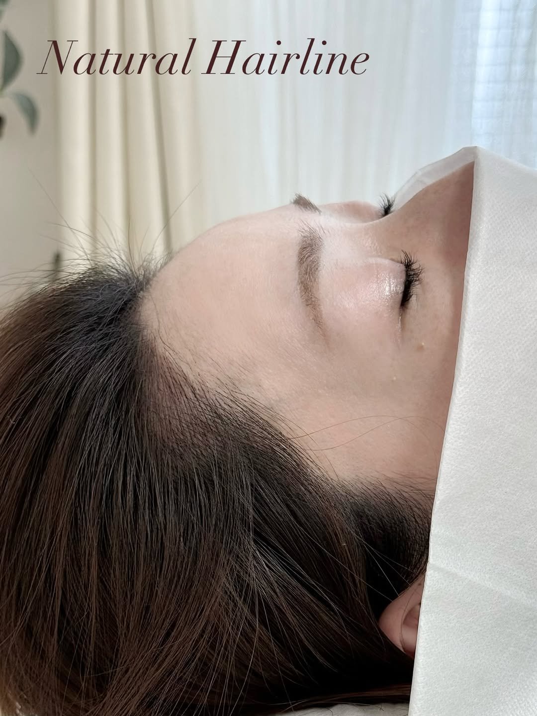 brow_look_ 게시물 이미지: ✔️
넓어 보이던 이마, 흐릿했던 헤어라인
자연스럽게 채워드립니다 🤍
...