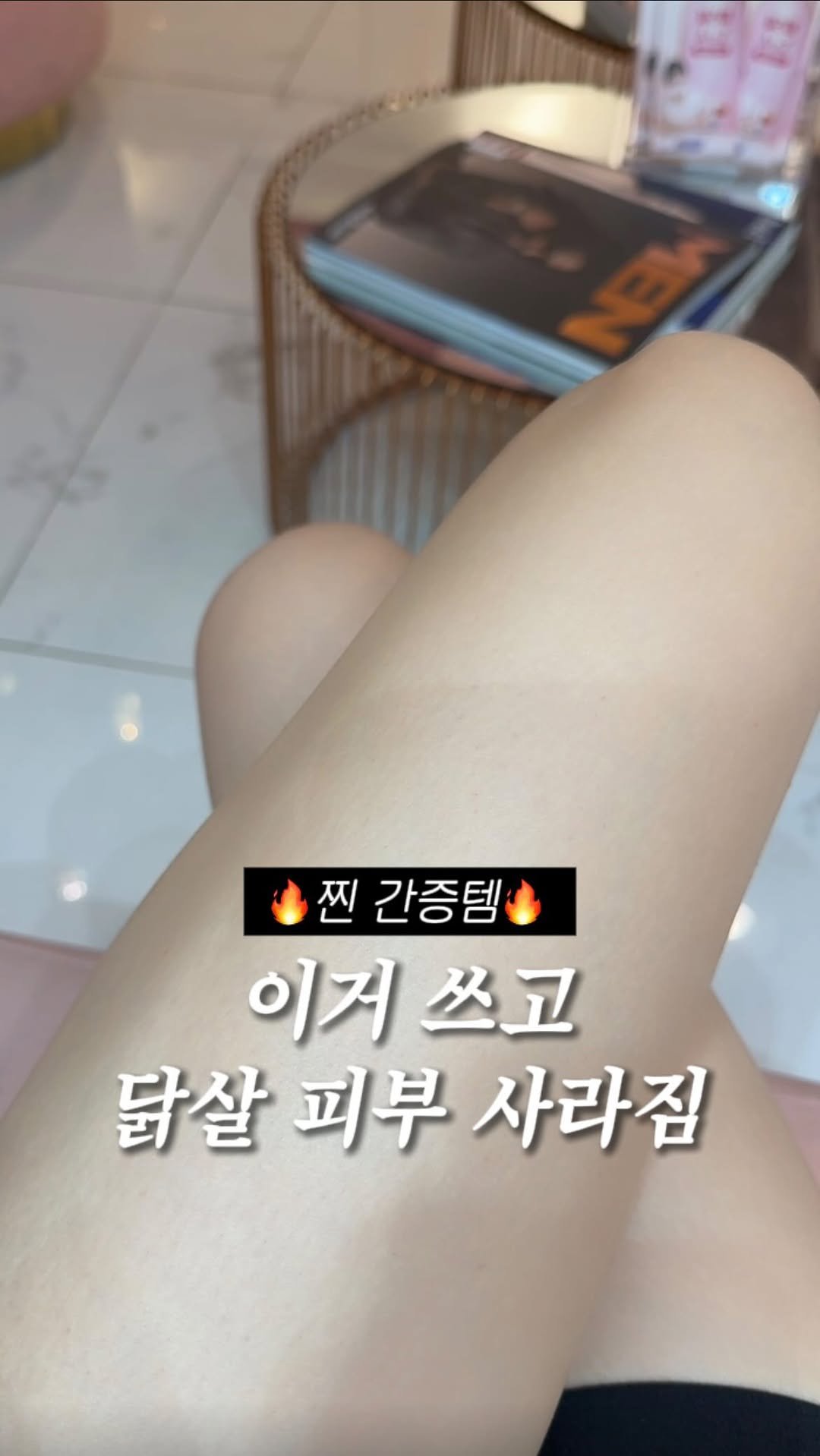 brown.beauuuty 게시물 이미지: 저장•공유📌) 종아리 닭살 피부 때문에 짧은 바지 못 입으시는 분 주목!

제가...