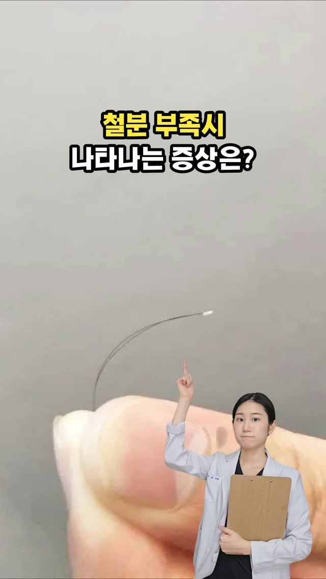 byak_yaksa 게시물 이미지: 🩸 철분 부족시 나타나는 증상 8가지
 
 
1️⃣ 어지럼증

뇌로 전달되는 산소가...