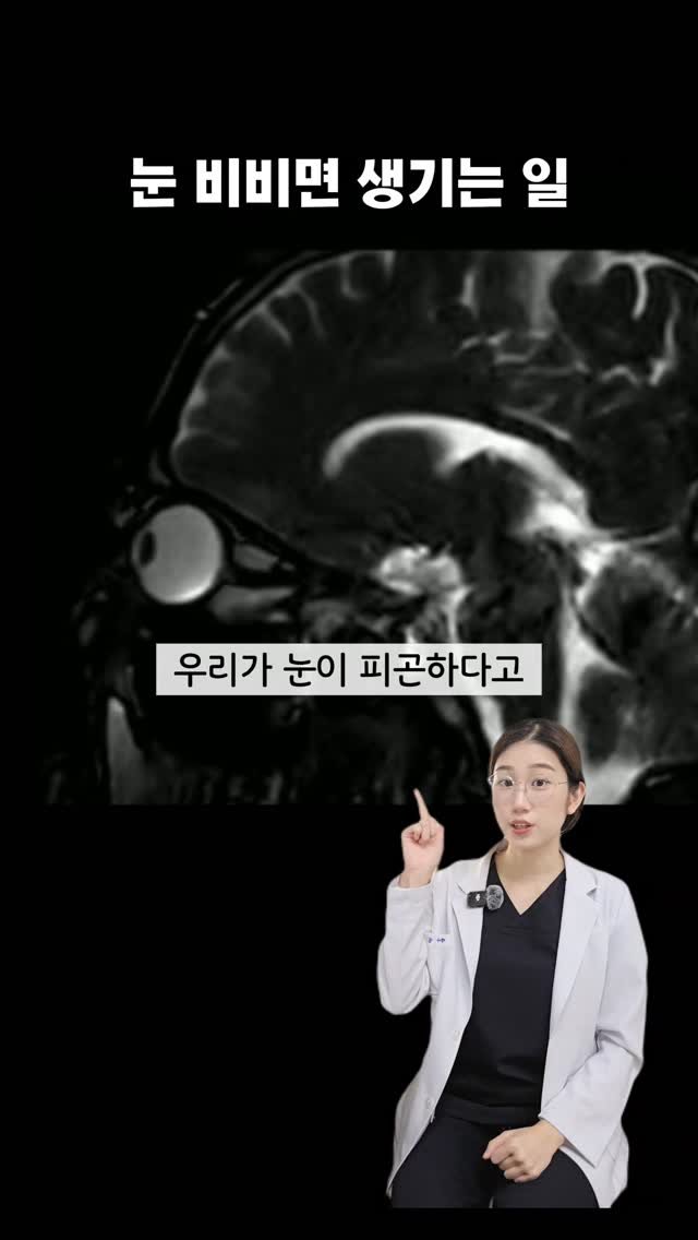 byak_yaksa 게시물 이미지: 🔥 명절에 다들 티비, 휴대폰 많이 보실거잖아요 🔥
눈 비비지 마시고, 이렇게...