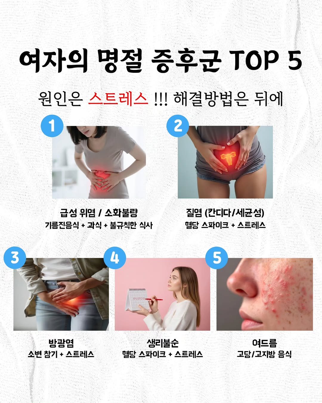 Photo by 삐약 약사 | 여성건강 1타 약사 | 임나현 on February 13, 2026. May be an image of pie and text that says '여자의 명절 증후군 TOP 5 원인은 스트레스!!! 해결방법은 뒤에 1 2 2 급성 위염 / 소화불량 기름진음식 + 과식 불규칙한 식사 3 질염 (칸디다 (칸디다/세균성) 세균섬) 열당 스파이크 + 스트레스 4 5 5 พพด 방광염 소변 소변참기 참기 소변참기+스트레스 + 스트레스 생리불순 열당 스파미크 + 스트레스 여드름 고담/고지밤 고지밤 음식'.