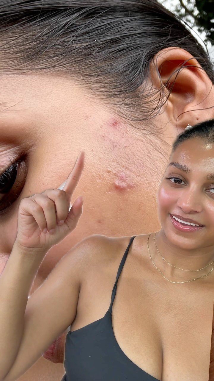 byzareefa 게시물 이미지: my skin #transformation ✨
🍯Products are...