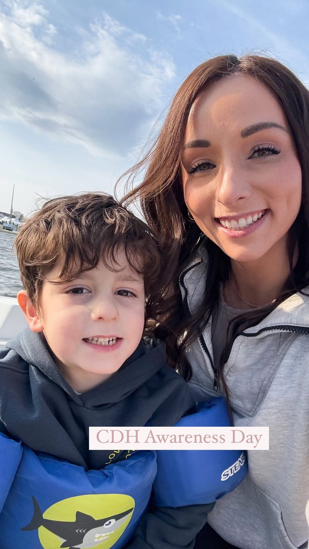 caramurtaugh 게시물 이미지: “He has a congenital diaphragmatic hernia.”...