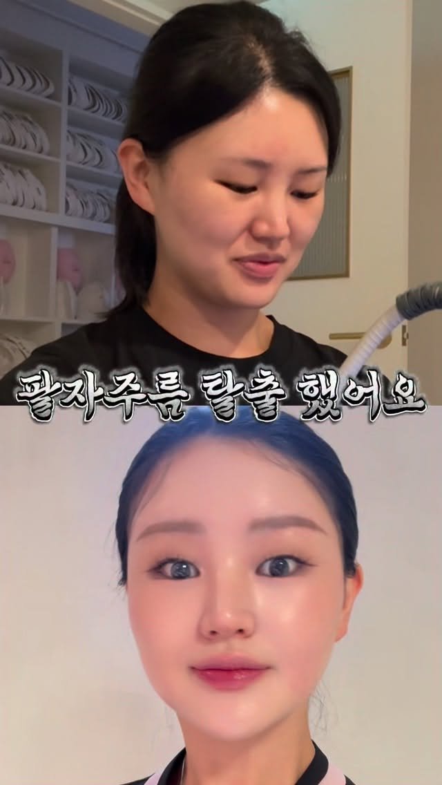 cclime_nana 게시물 이미지: ✨ 하루 5분, 집에서도 미친 에스테틱 윤곽관리를 한다고 ?
나나쌤 비밀링크는...