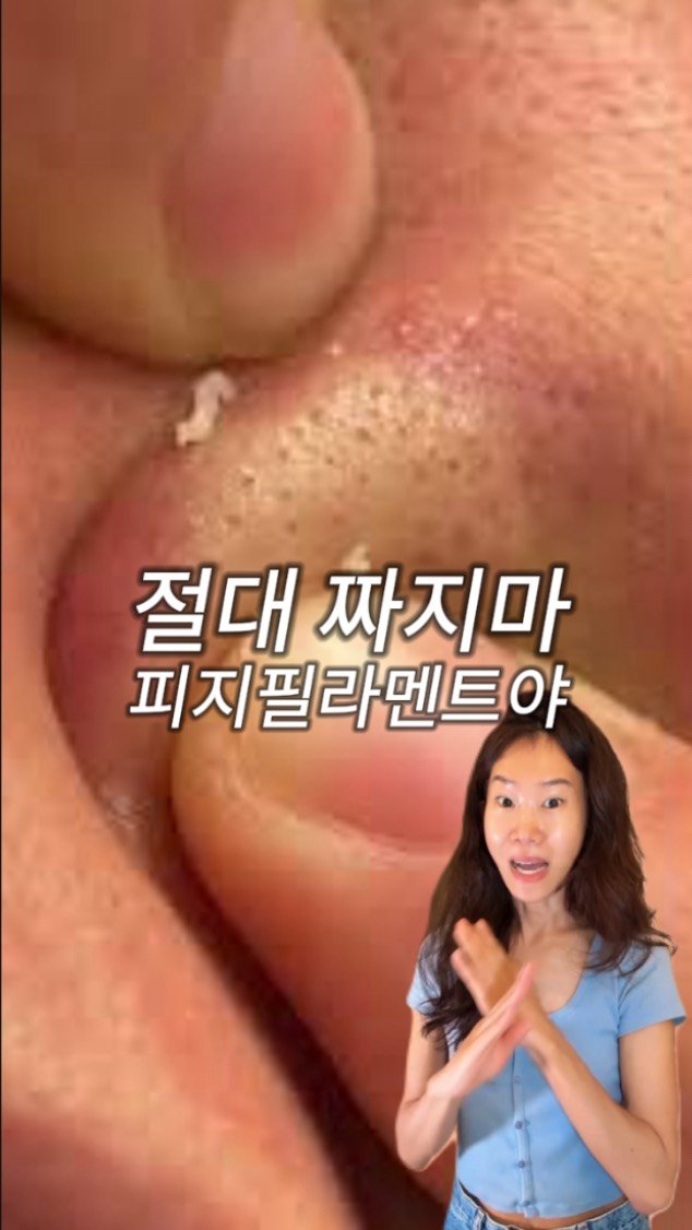 ceci_yaksa 게시물 이미지: 🔥약사가 2주만에 피지필라멘트·블랙헤드 없애는 루틴🔥 
여름에 문의 너-무 많아서...