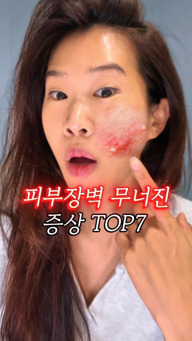 ceci_yaksa 게시물 이미지: 🔥피부장벽 무너졌을 때 나타나는 증상들🔥 
🙋🏻‍♀️울 친구들은 몇 개나...