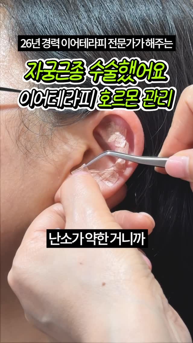 celbio_eunha 게시물 이미지: 댓글에 ⭐호르몬⭐ 남겨주시면
영상 속에서 사용한 혈자리 정리해서
전자책으로...