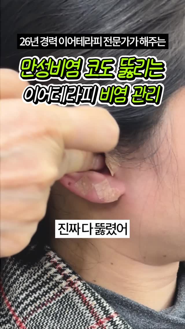 celbio_eunha 게시물 이미지: 댓글에 ⭐비염⭐ 남겨주시면
영상 속에서 사용한 혈자리 정리해서
전자책으로...