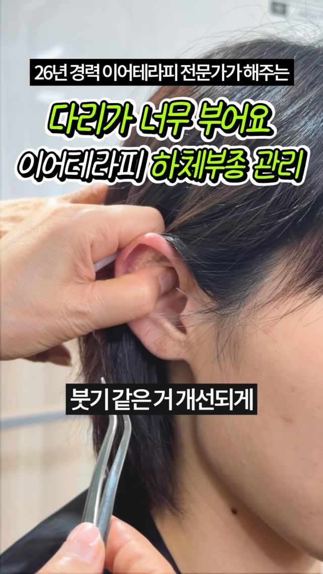 celbio_eunha 게시물 이미지: 댓글에 ⭐다리⭐ 남겨주시면
영상 속에서 사용한 혈자리 정리해서
전자책으로...