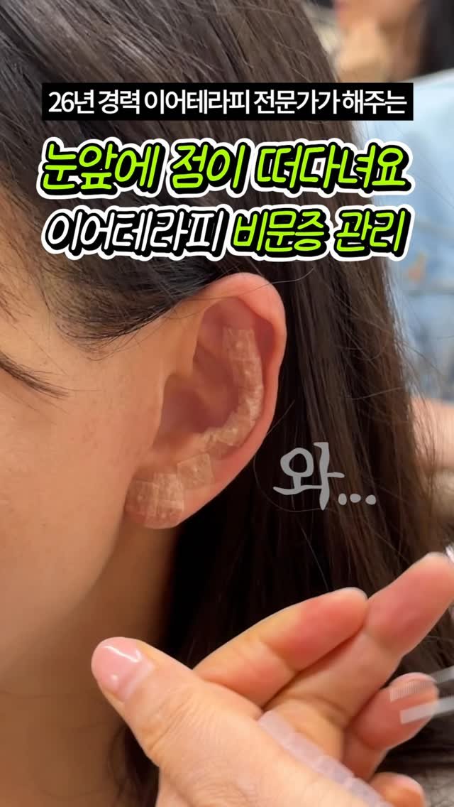 celbio_eunha 게시물 이미지: 댓글에 ⭐비문증⭐ 남겨주시면
영상 속에서 사용한 혈자리 정리해서
전자책으로...