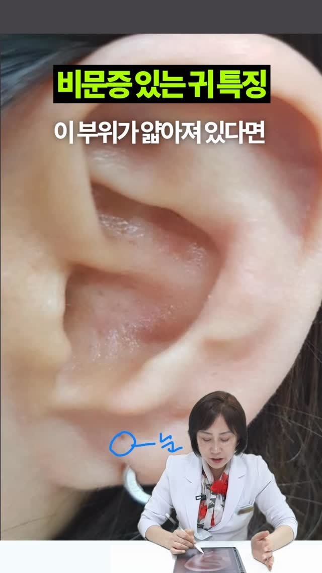 celbio_eunha 게시물 이미지: 비문증 있는 사람들은 이런 신호가 나타납니다 🚨

💌 댓글에 ‘저요’ 남겨주시면...