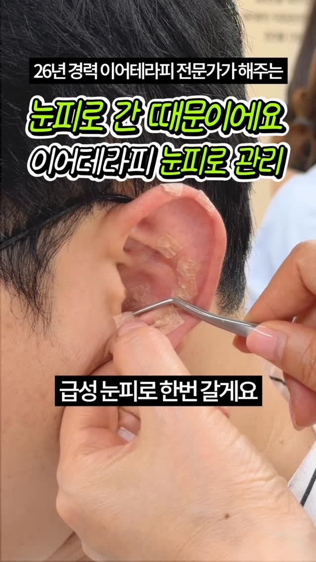 celbio_eunha 게시물 이미지: 댓글에 ⭐눈피로⭐ 남겨주시면
영상 속에서 사용한 혈자리 정리해서
전자책으로...