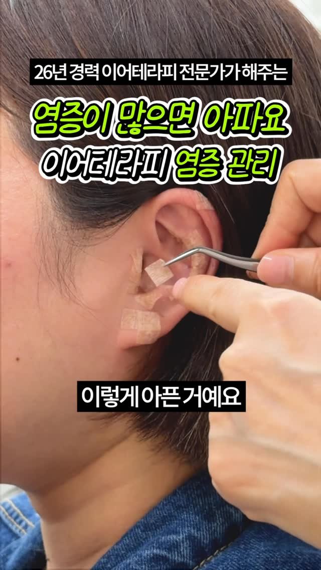 celbio_eunha 게시물 이미지: 댓글에 ⭐염증⭐ 남겨주시면
영상 속에서 사용한 혈자리 정리해서
전자책으로...