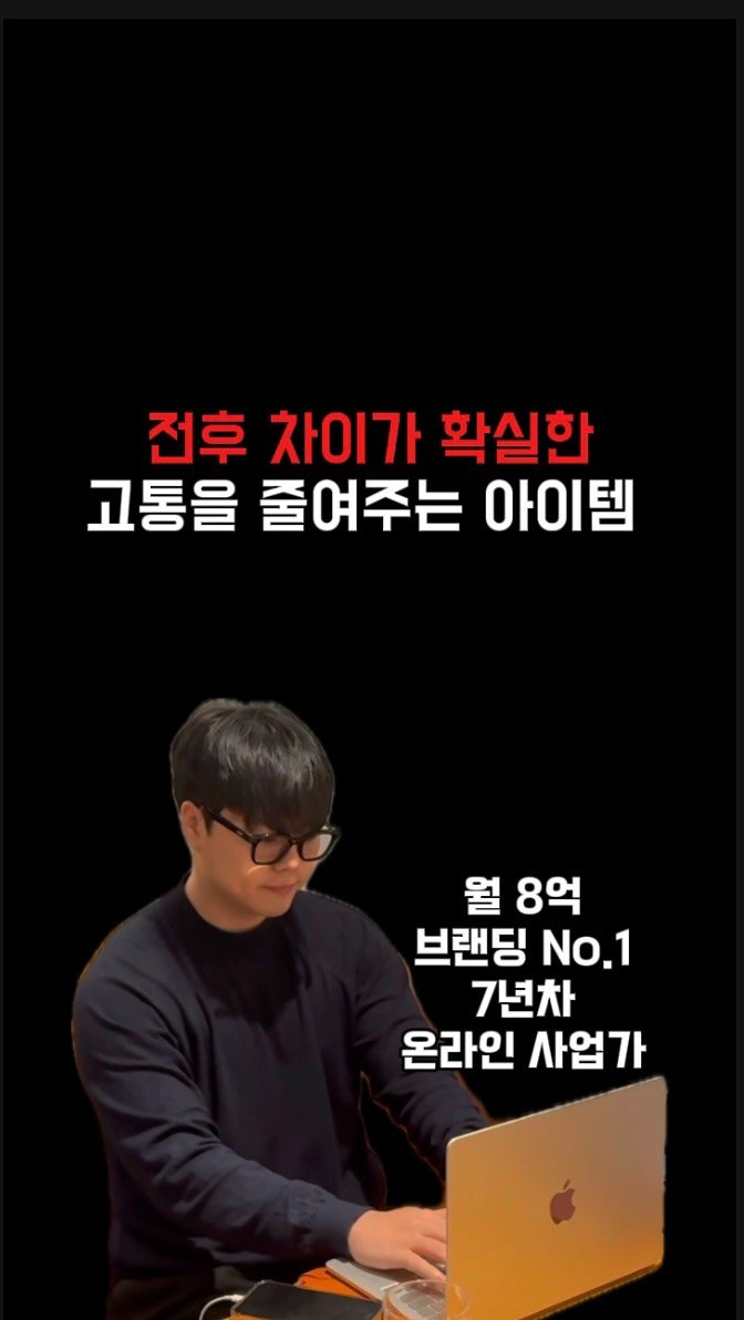 ceo_jin21 게시물 이미지: 전후 차이가 확실한 고통을 줄여주는 아이템 🩹

⸻

정말 천재적인...