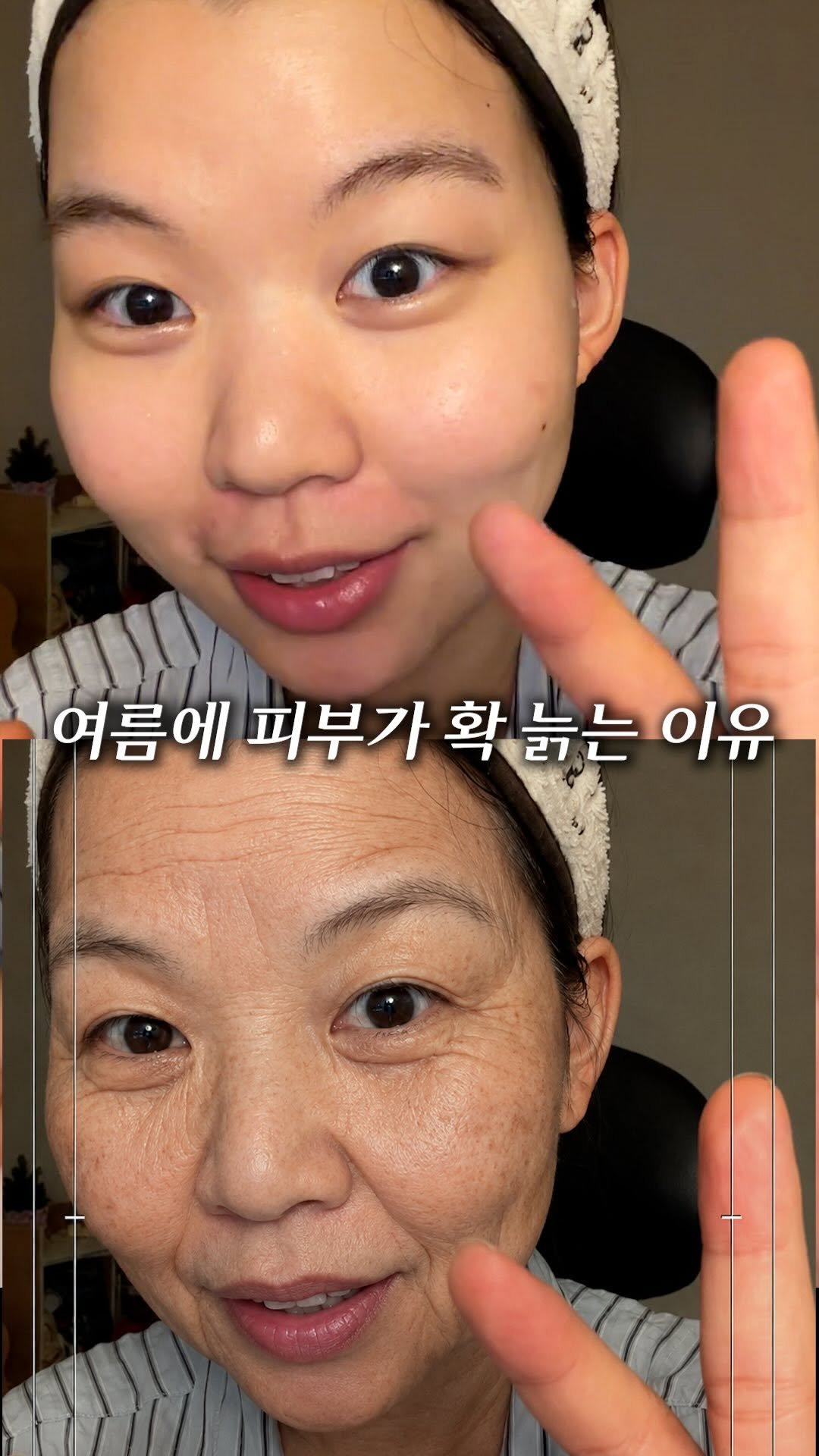 chaeng_trovely 게시물 이미지: 피부가 여름에 빨리 늙는 이유 #진행중 
(오류 때문에 재업로드 ㅠ.ㅠ)

얼굴에...