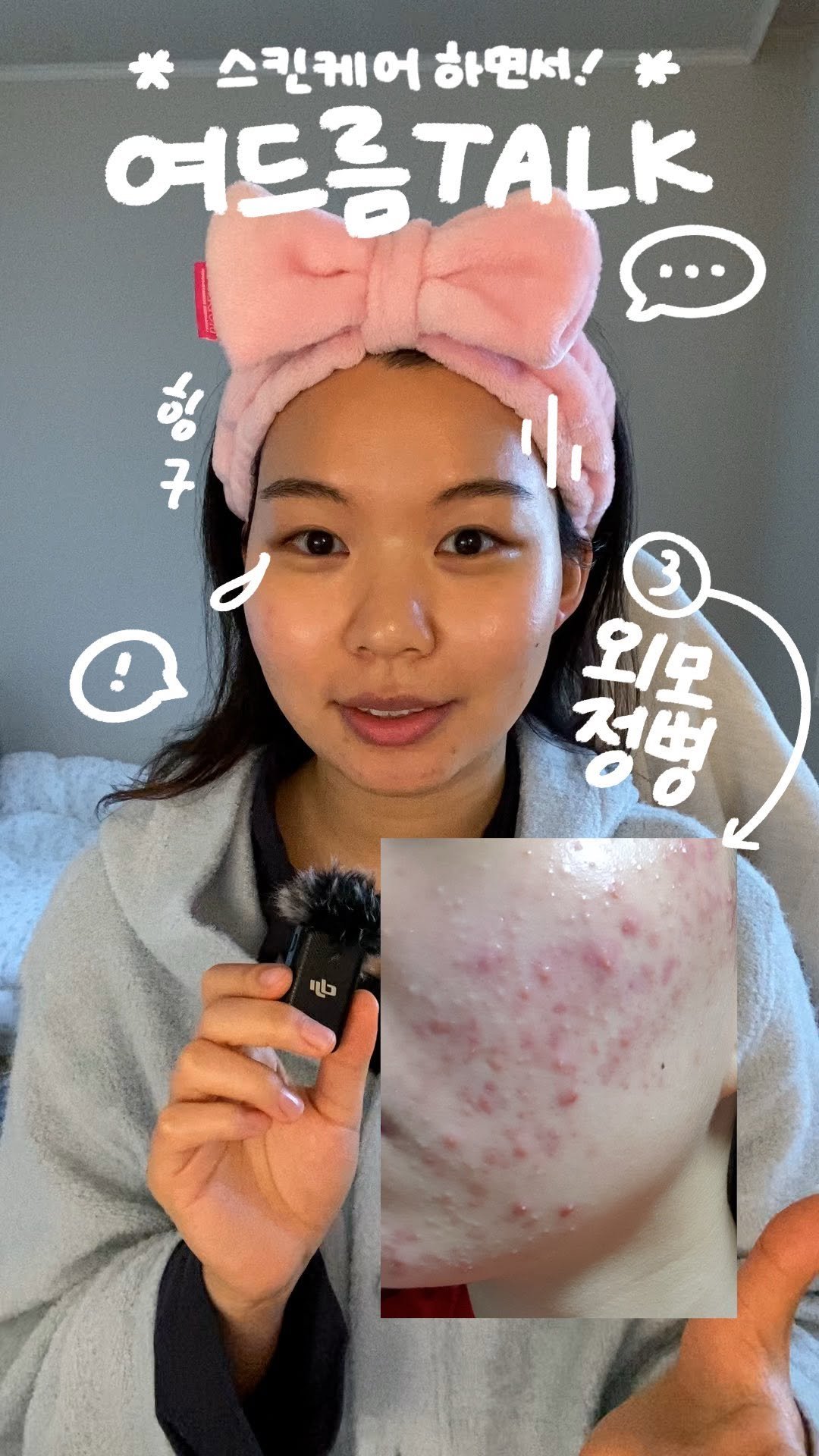 chaeng_trovely 게시물 이미지: (댓글이벤트💌)여드름 때문에 외모정병 난 썰🥹
 
생각해보면 여드름이 나기...